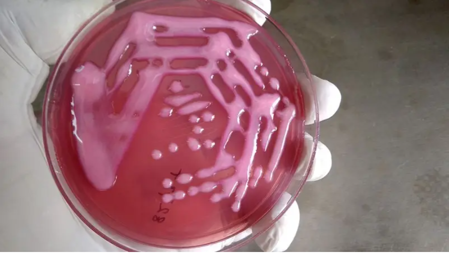 El Destape: Bill & Melinda Gates Foundation 